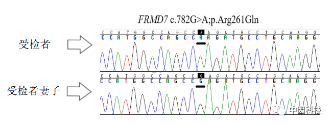 arg261gln,受检者该位点为半合子变异,受检者妻子该位点为野生型,无