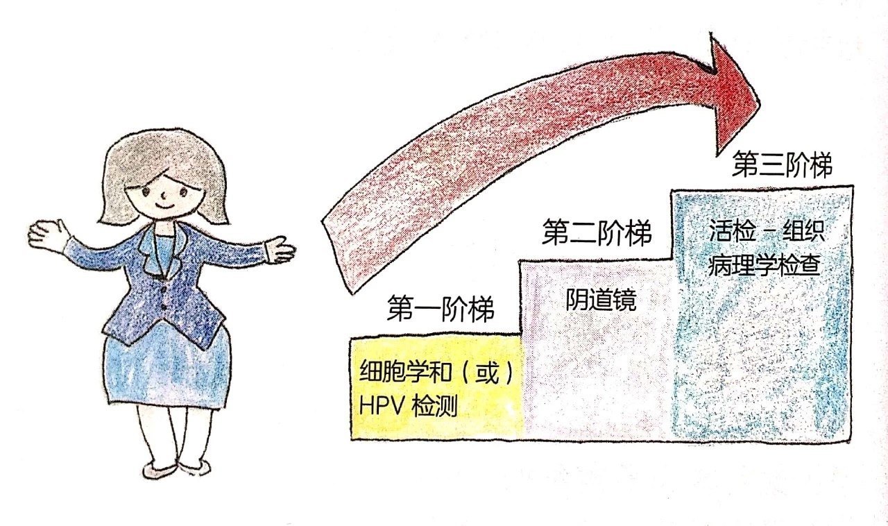 宫颈组织学分层示意图图片