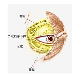 祛眼袋术后出现下睑退缩怎么办