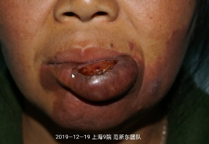 暂无