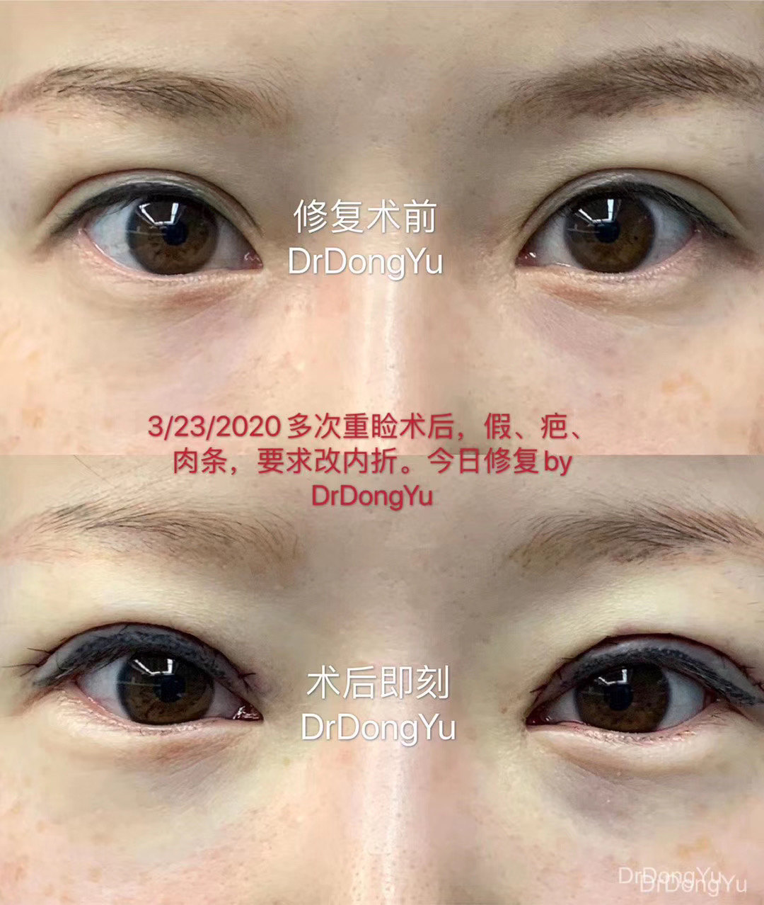 暂无