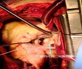 1574391543456519.png image.png