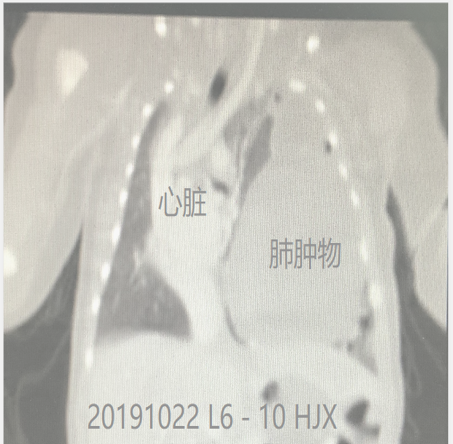 1576419117767104.png image.png