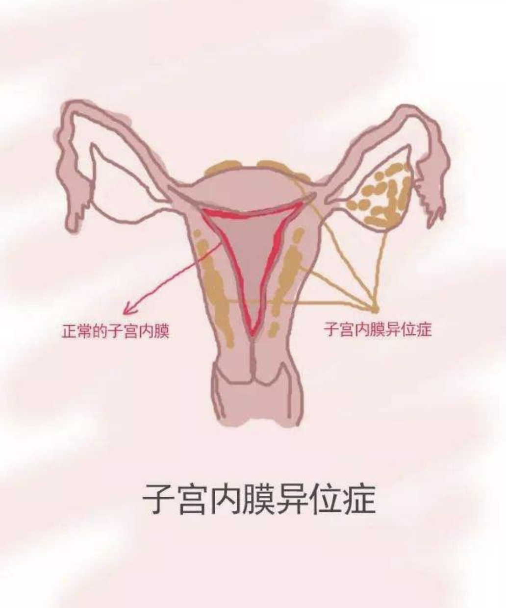 子宫附件解剖图谱图片