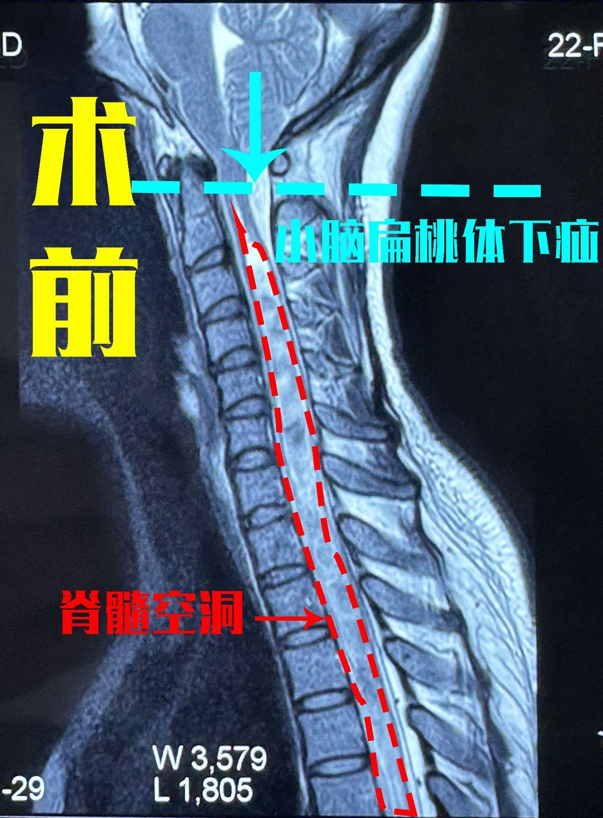 yoYBAGbTq5OARDZAAAP7-YqcN88440.png?_ms_=4feb