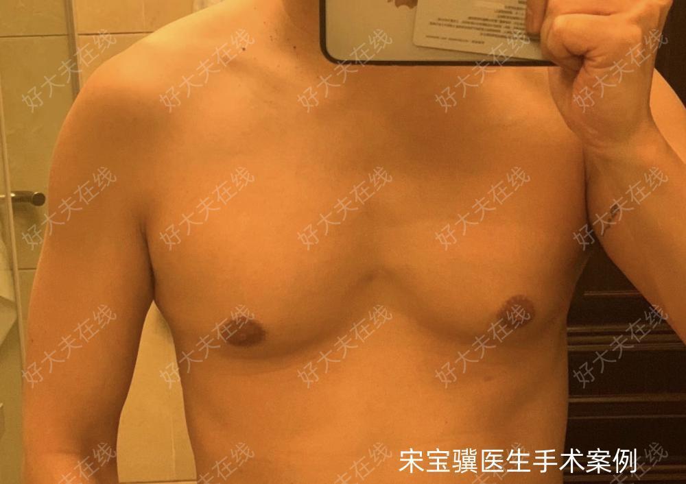 圖文圖片