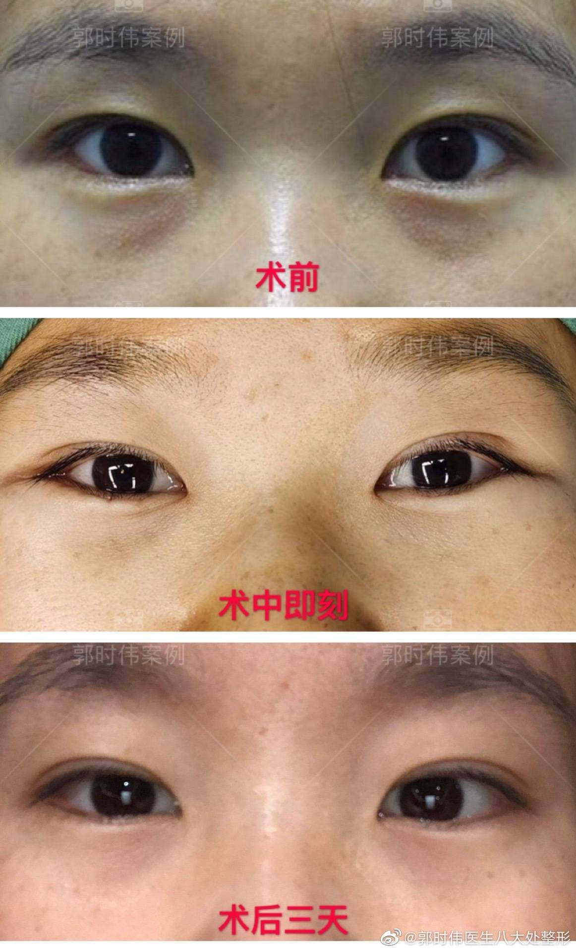 包含北京八大处整形医院专家代挂不用排队,轻松看病的词条 包含北京八大处整形医院专家代挂不用排队,轻松看病的词条