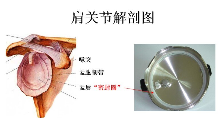 盂唇解剖位置图片