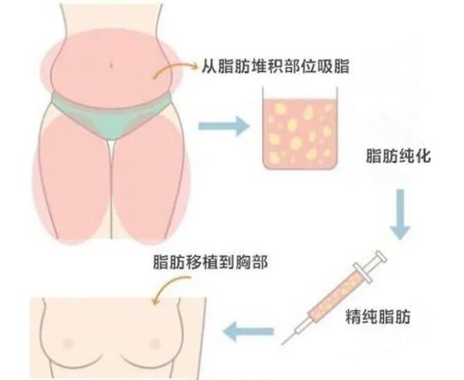四十如何丰胸 wIYBAF-jzhmAXC-iAAB0BsMa7q0390.jpg?_ms_=1729