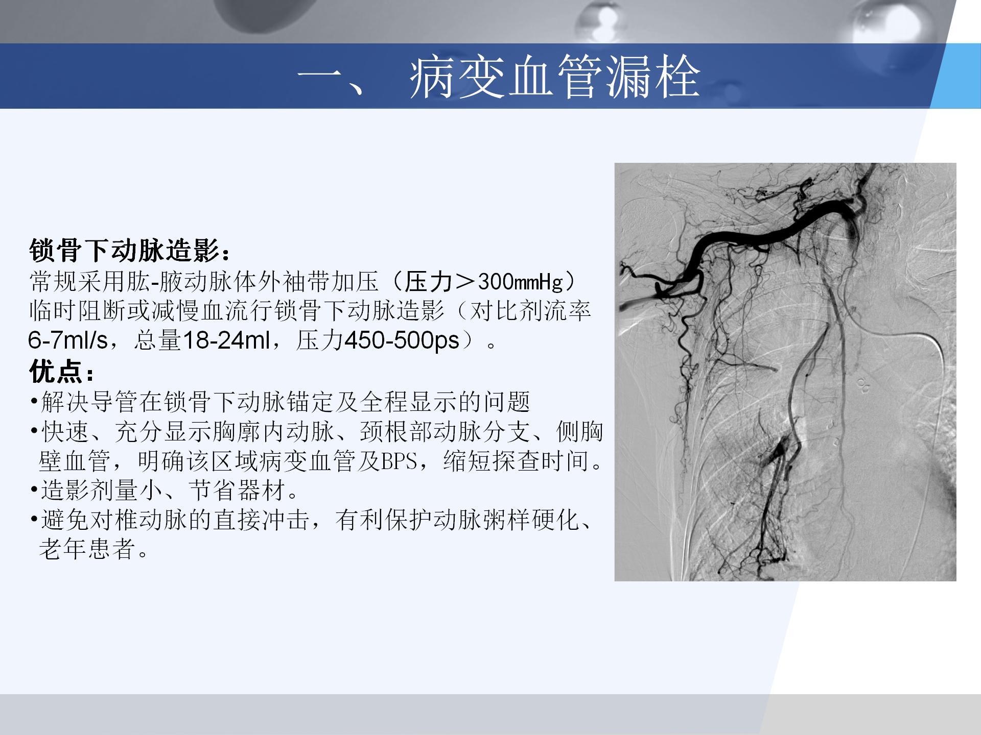 广医附一院-咯血病例汇报 [自动保存的]_16.jpg