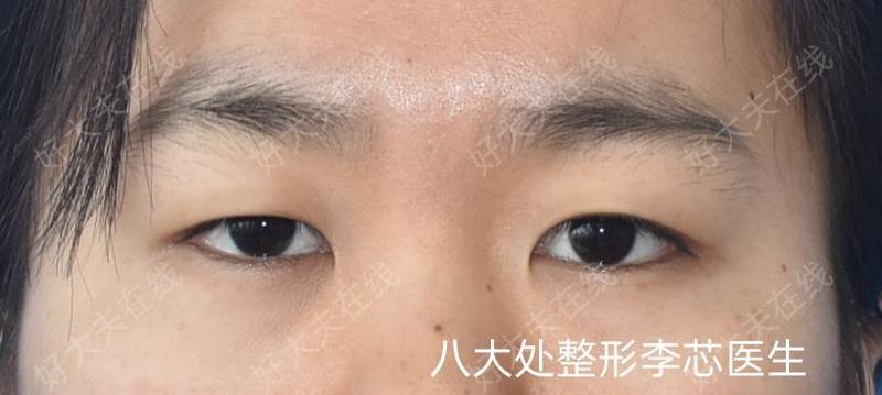 圖文圖片