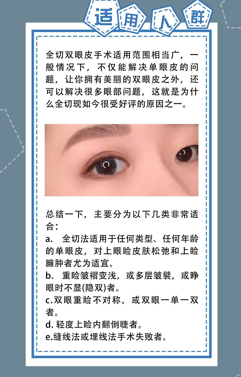 伍航利老师双眼皮科普1——全切_03.gif