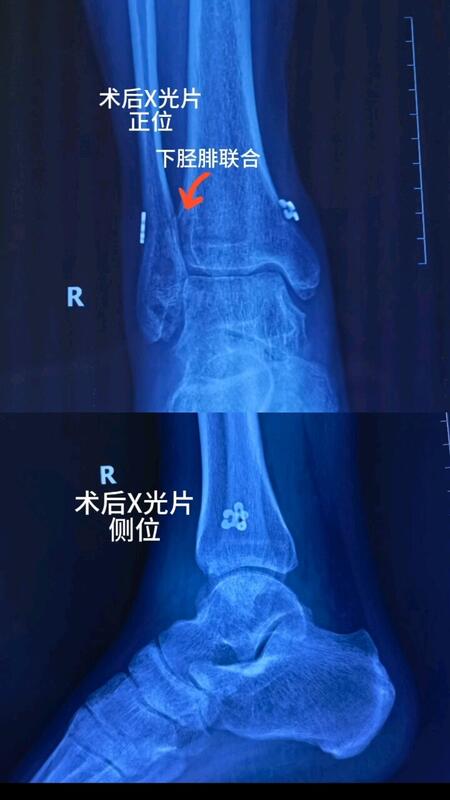 視頻封面