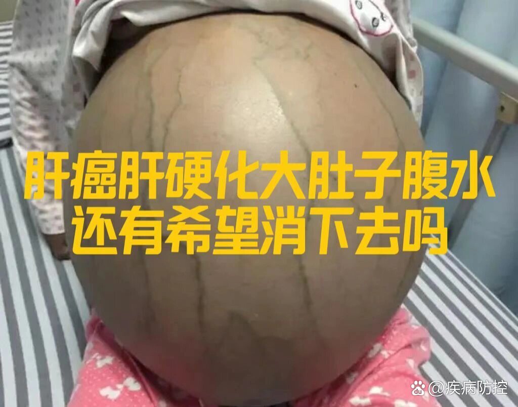 圖文圖片