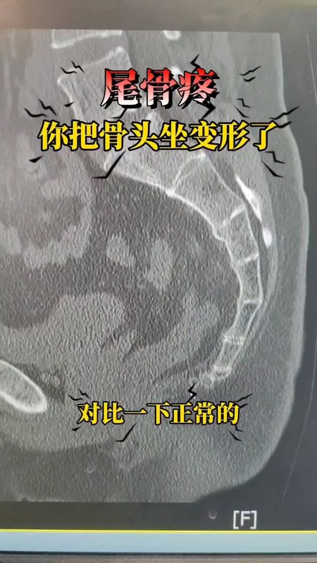 視頻封面