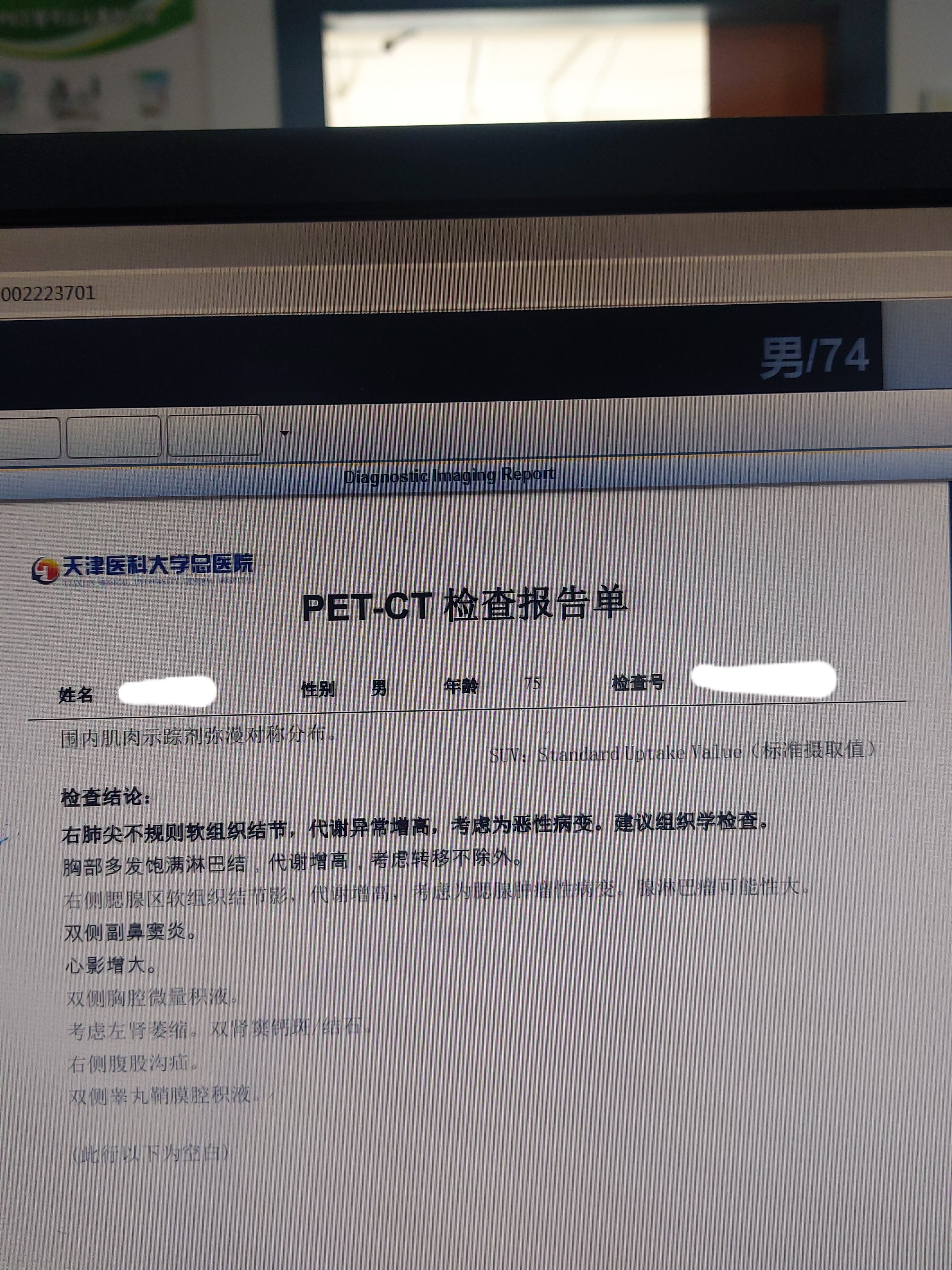 肺癌_介绍_检查 - 好大夫在线