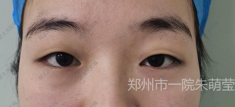 圖文圖片