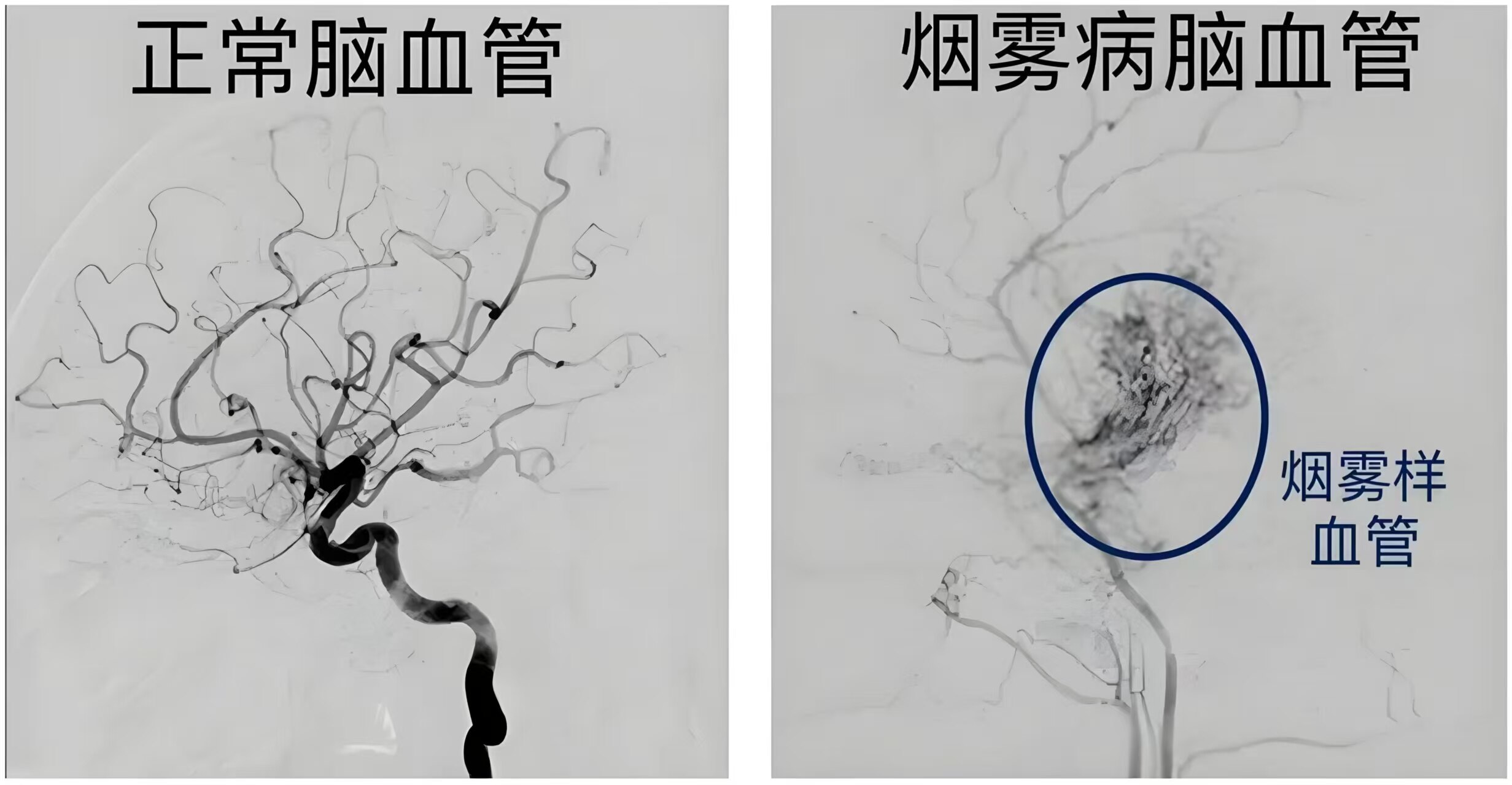 圖文圖片