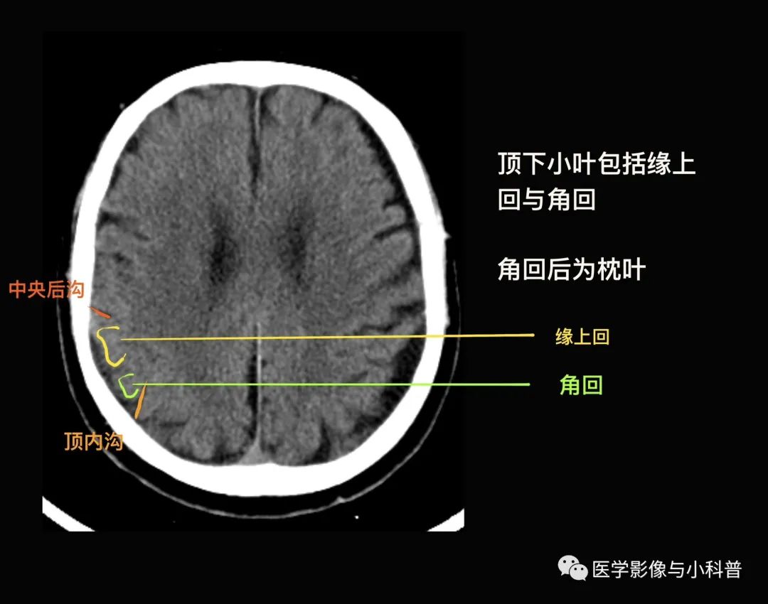 顶下小叶角回图片