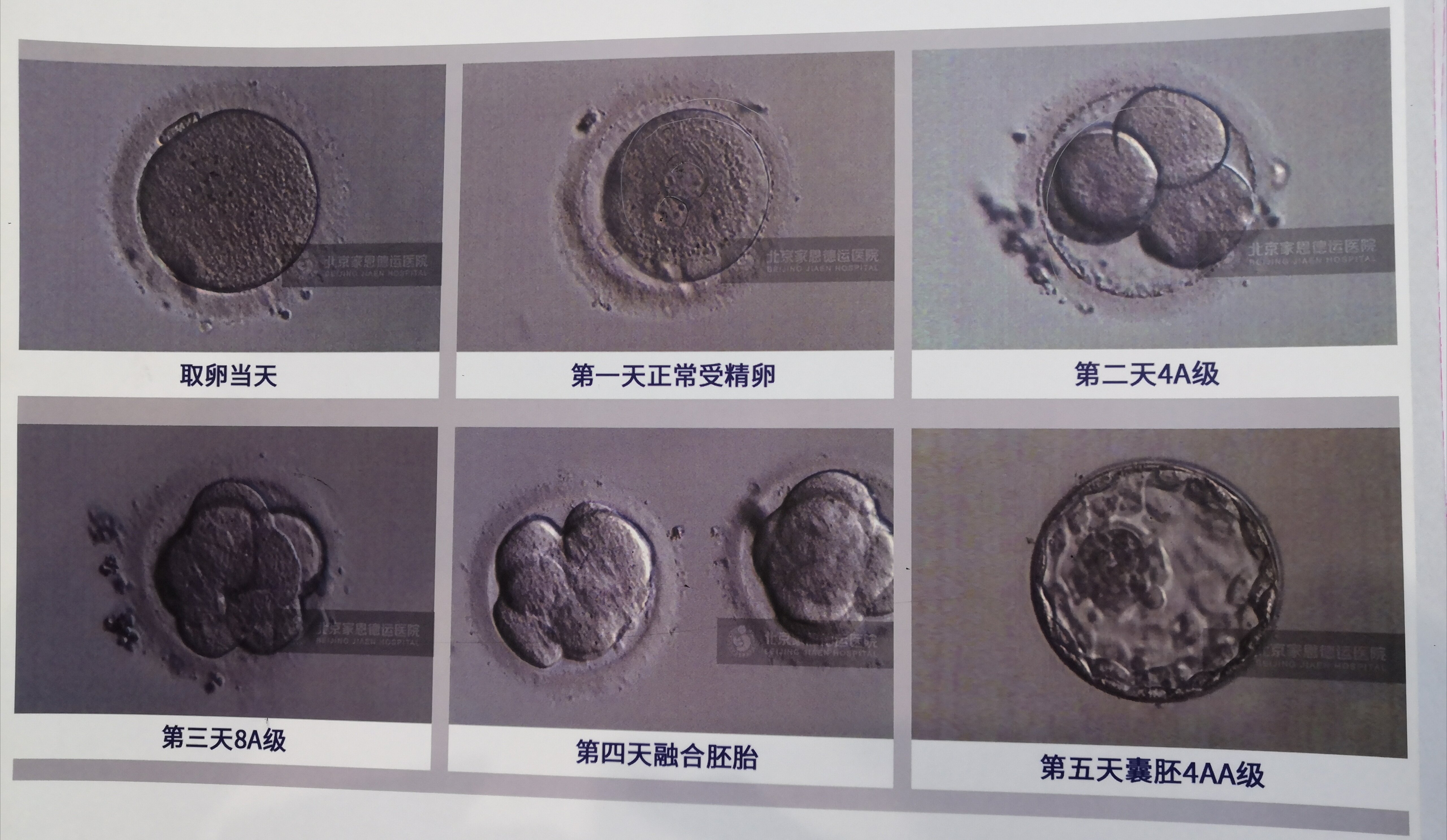 鮮胚囊胚凍胚哪個移植成功率剛高