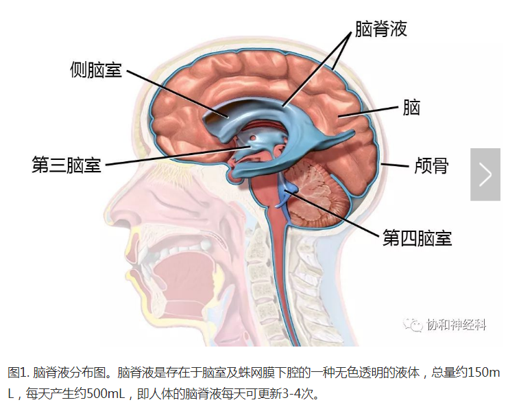 腰穿 请您别紧张 蛛网膜下腔出血 蛛网膜下腔出血检查 好大夫在线
