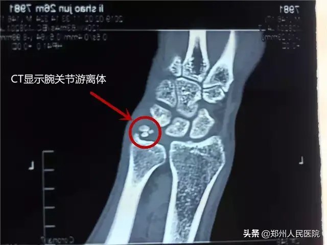 暂无