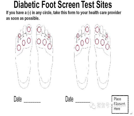 3. 10g尼龙丝检测点:⑶. 重度梗阻:基本已无明显峰值.⑵.