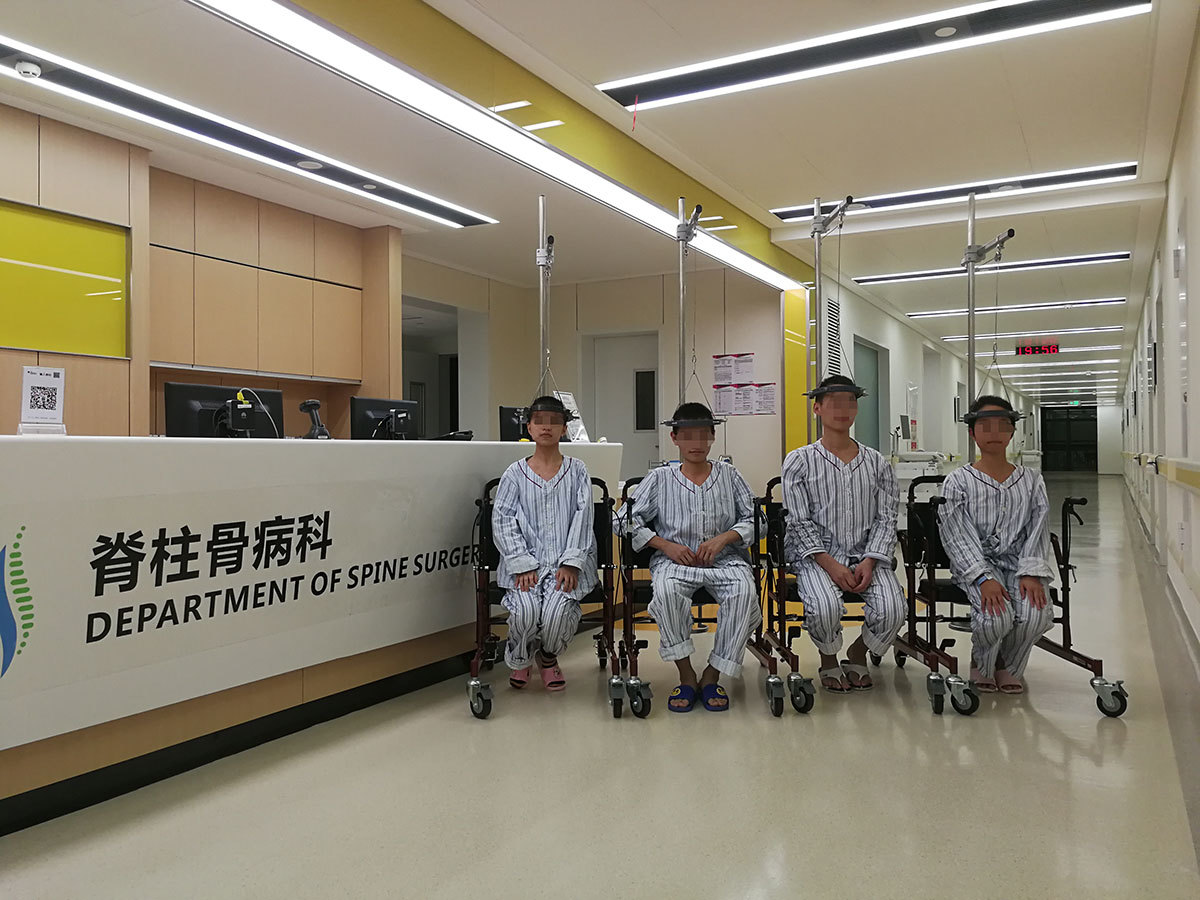 重度脊柱侧弯术前halo头环牵引有用吗 牵引90天案例展示 脊柱侧弯 治疗方法 手术 重度脊柱侧弯术前halo头环牵引有用吗 牵引90天案例展示 脊柱侧弯 治疗方法 手术