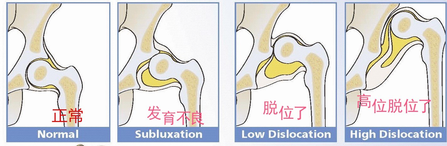 儿童骨盆图片