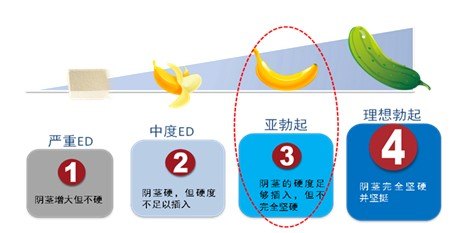 男人勃起就像水库装水 - 好大夫在线