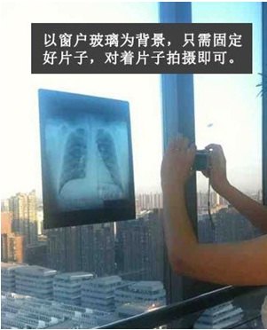 如何在家中拍出高质量的医学影像图片 - 好大夫