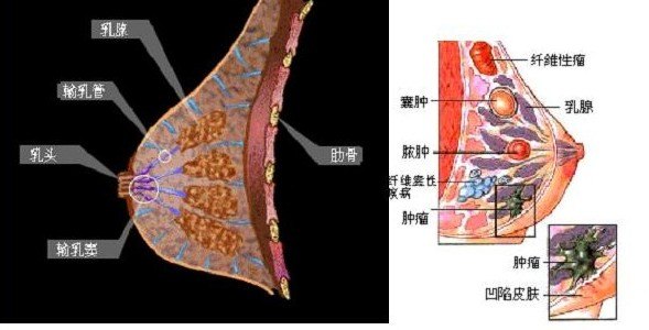 症状篇004——什么样的乳房肿块更像癌? - 好大夫在线