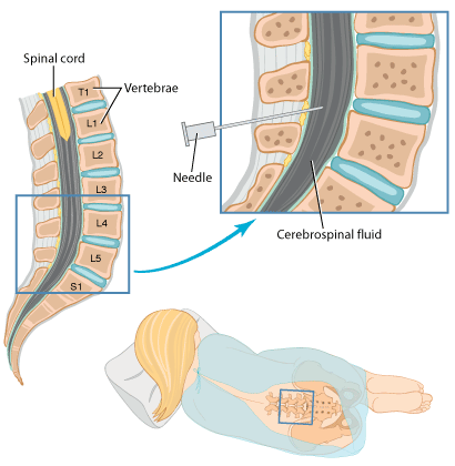 腰椎穿刺部位体表定位图片
