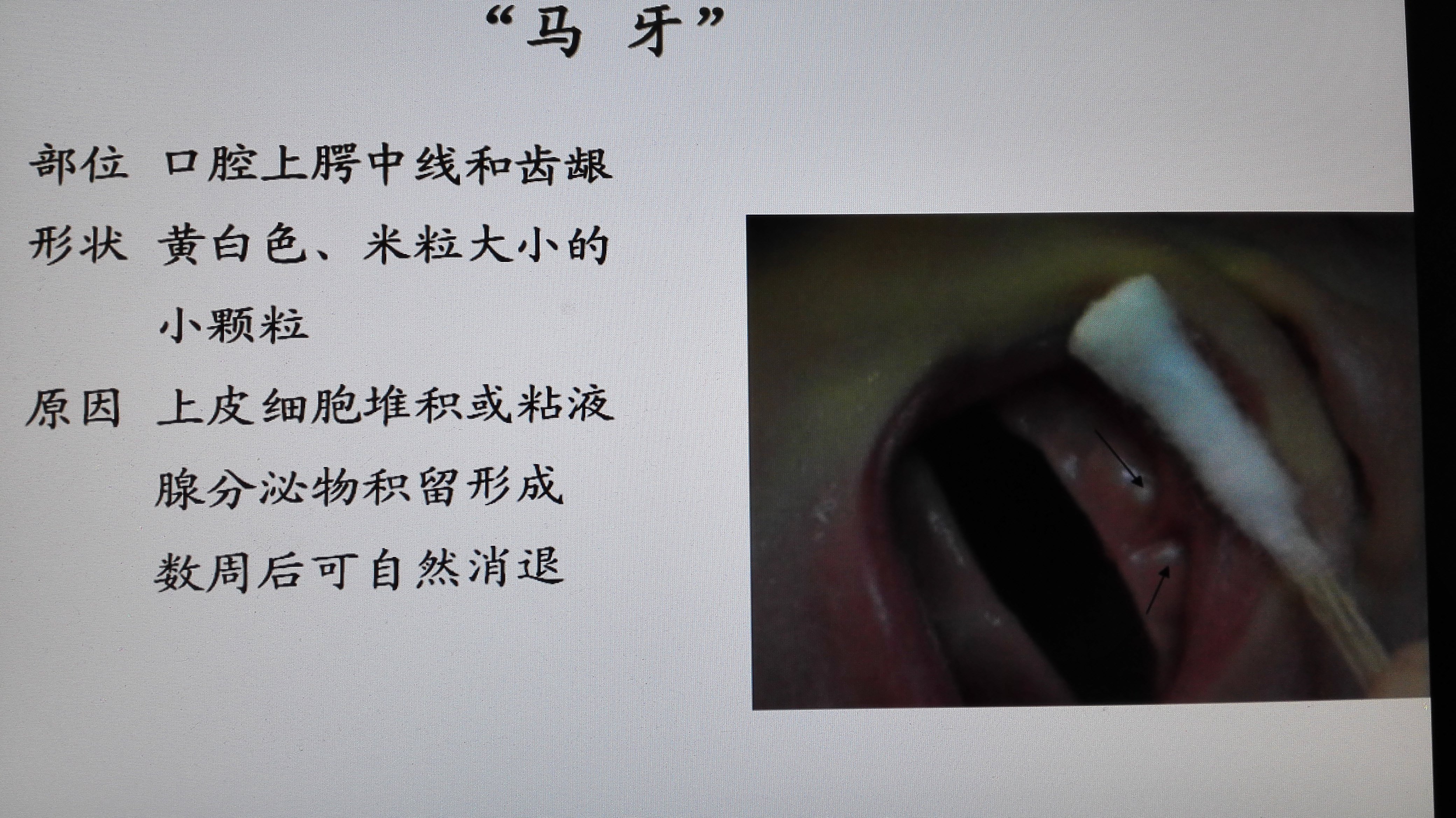 马牙口腔图片