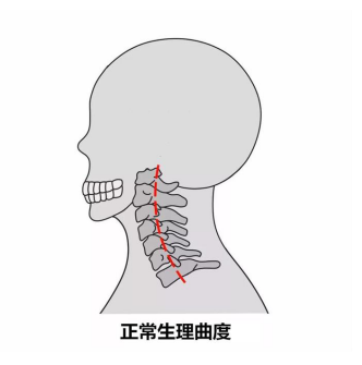 颈椎生理曲度消失是怎么还回事?能恢复吗?