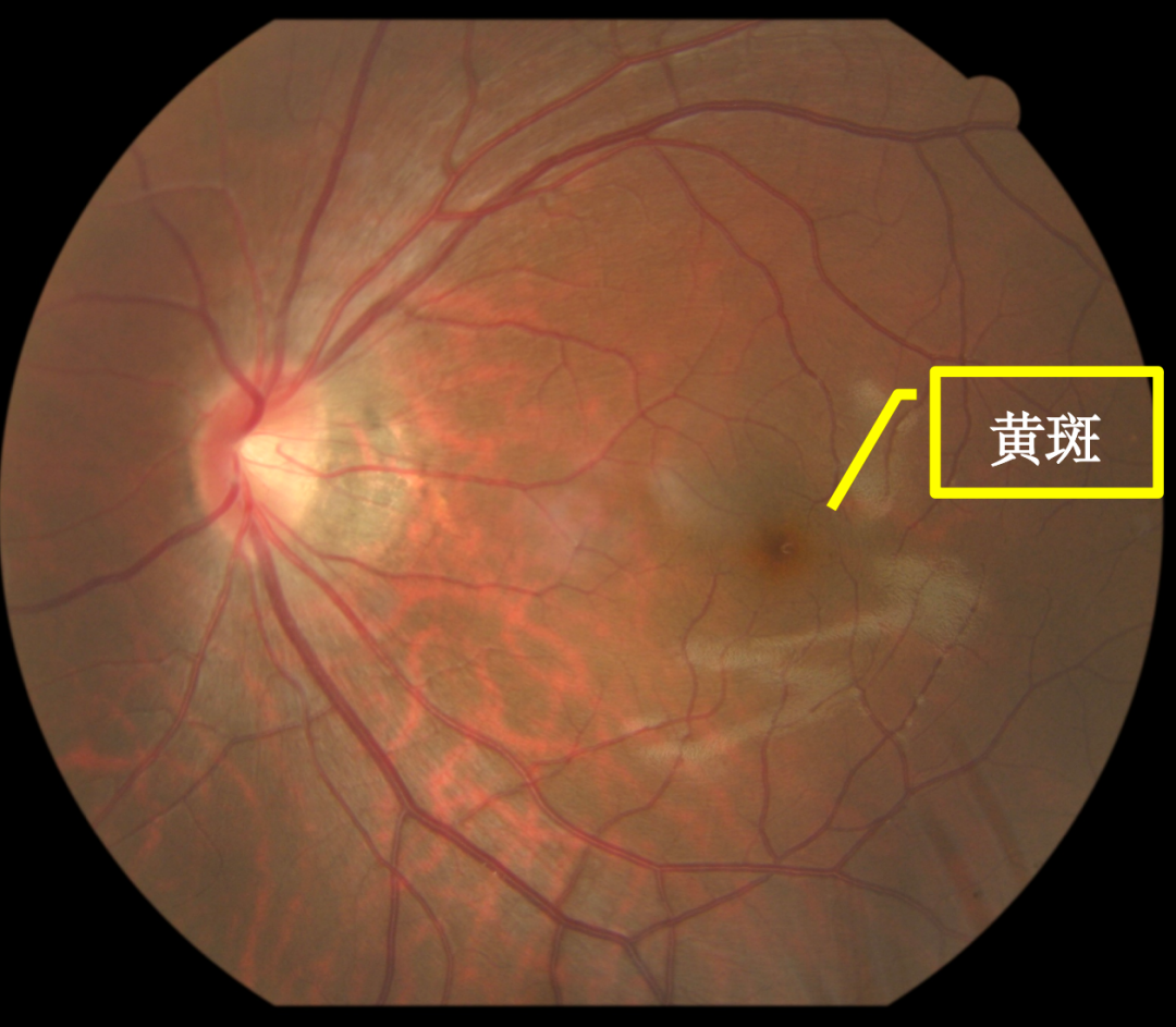 圖文圖片