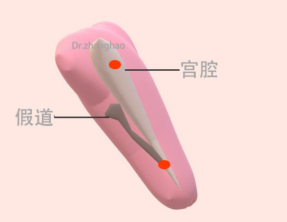 圖文圖片