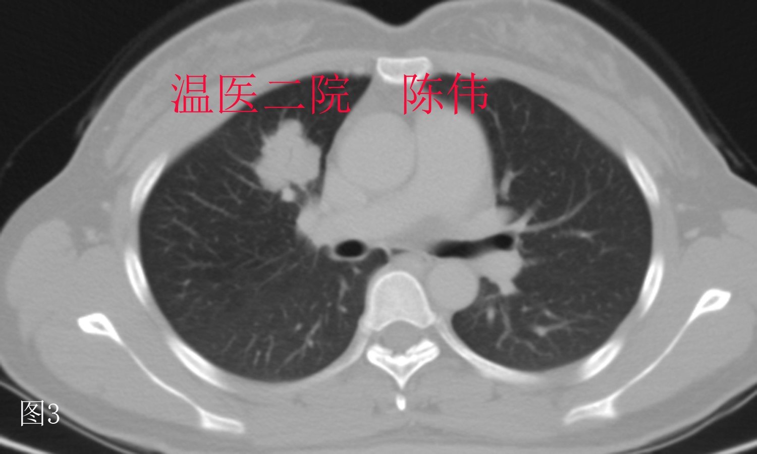 2222副本副本.jpg