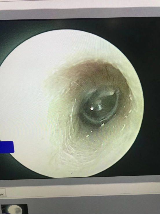 耳朵里白色的东西图片图片