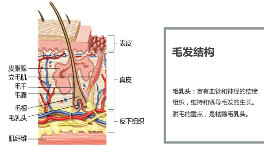 半導體激光脫毛