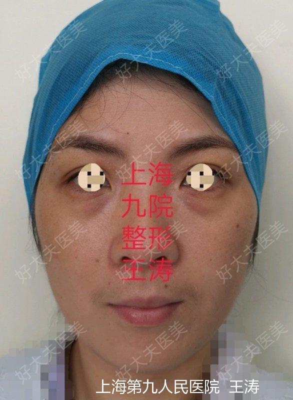 圖文圖片