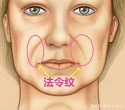 才30岁脸上就开始长法令纹了该怎么办有没有好的办法消除