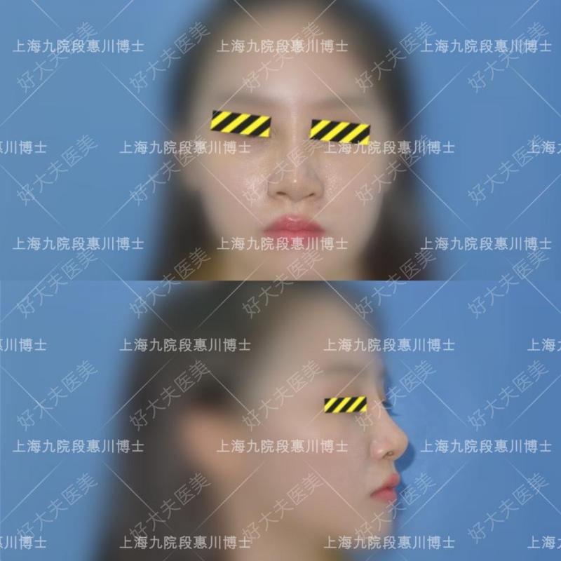 圖文圖片