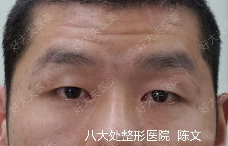 圖文圖片