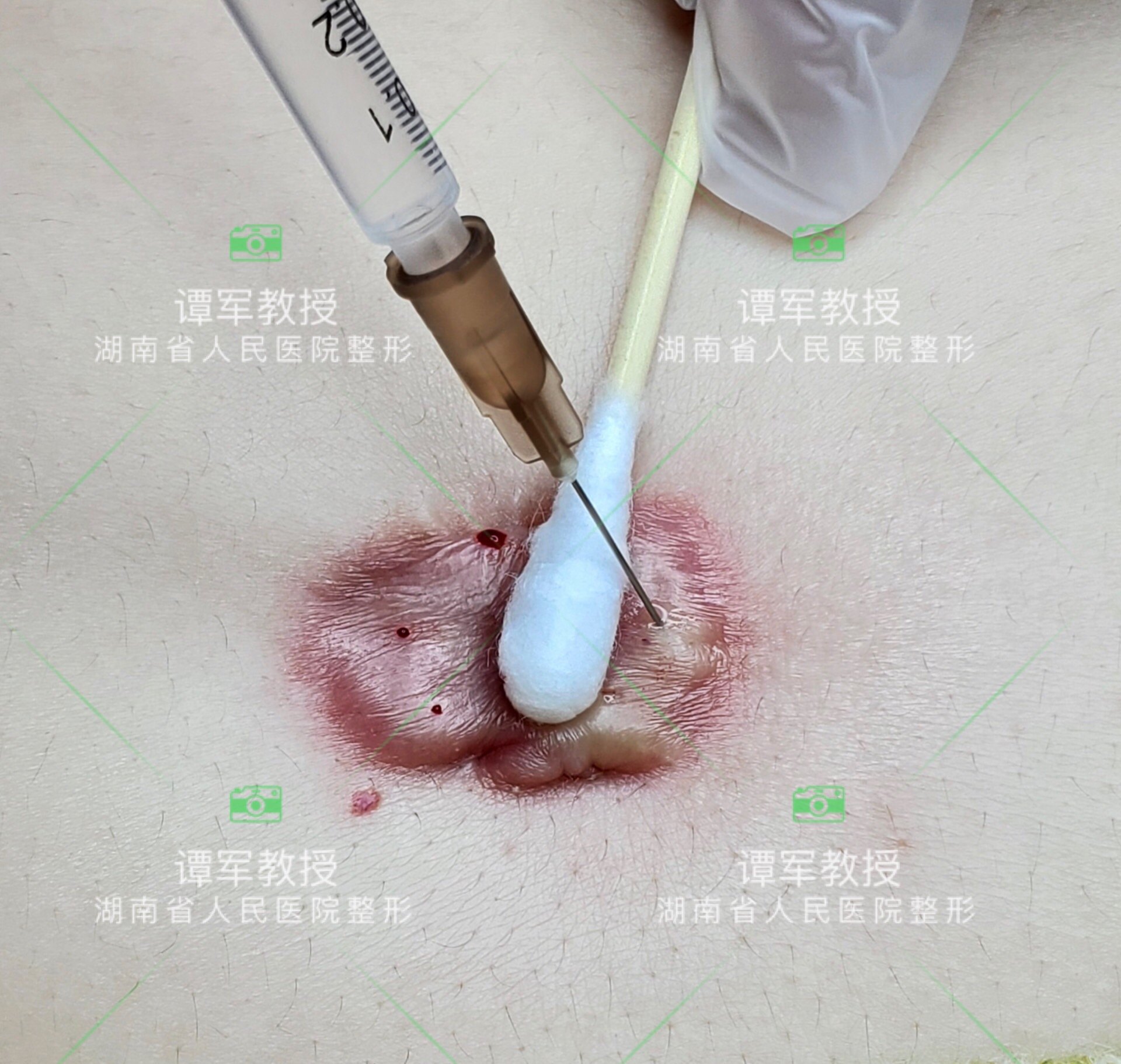 暂无