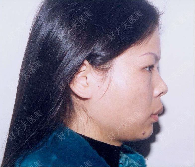 圖文圖片