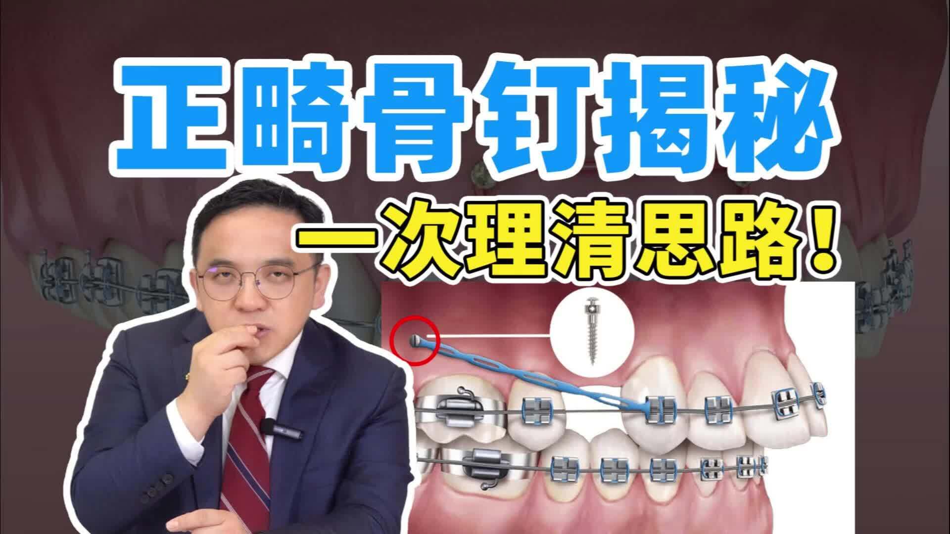 視頻封面