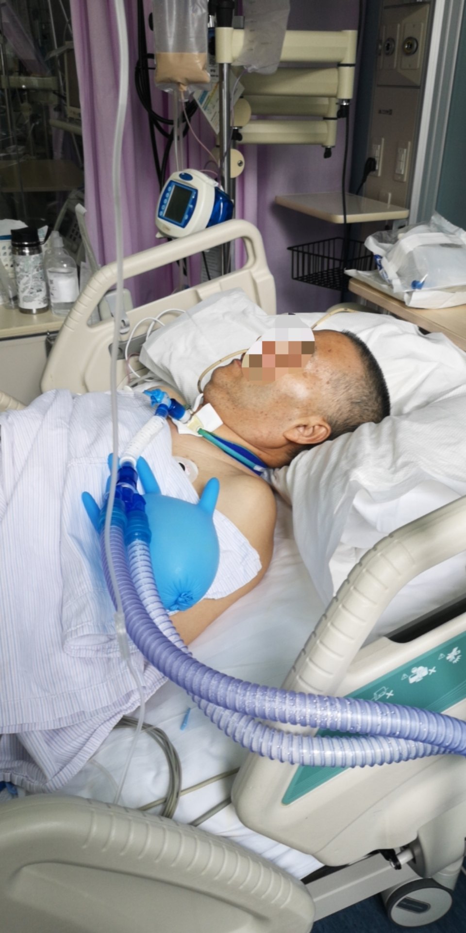 患者一周后脱离呼吸机,11月12日已经坐立床旁了