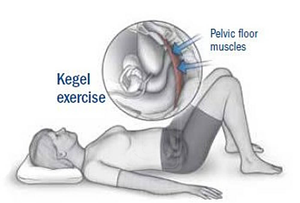 Hold-and-Squeeze-Kegel-Exercises-for-Women-and-Men[1].jpg