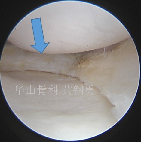 暂无